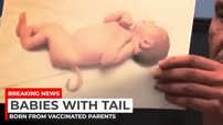 BABY BORN WITH LIZARD TAIL AND ONE EYE FROM VACCINATED PARENT